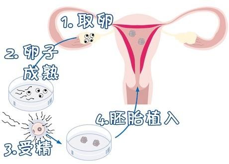 私人代怀公司